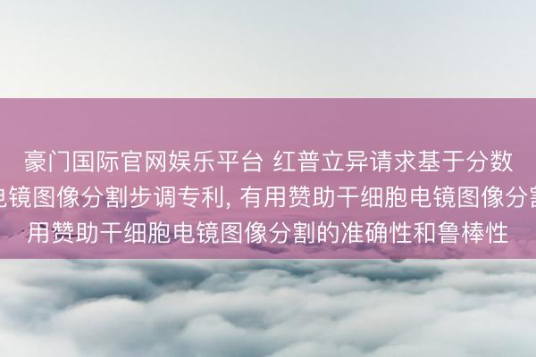 豪门国际官网娱乐平台 红普立异请求基于分数阶水平集的干细胞电镜图像分割步调专利， 有用赞助干细胞电镜图像分割的准确性和鲁棒性